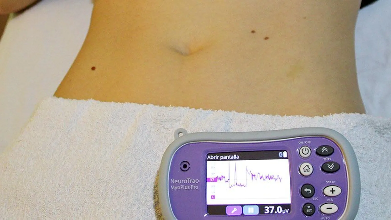 Valoración de fisioterapia de suelo pélvico en consulta