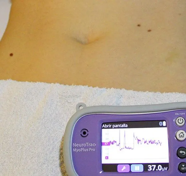 Valoración de fisioterapia de suelo pélvico en consulta